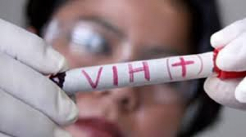 Diagnostican 12 casos de VIH-SIDA  en lo que va del año en Riberalta